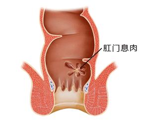 福州医博肛泰肛肠医院预约挂号